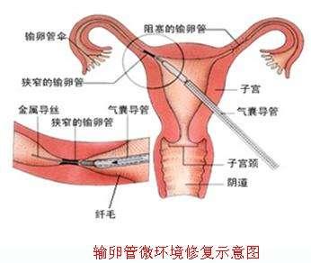 通草的功效与作用能通输卵管堵塞_最佳精选核心落实_BT222.88.27.39